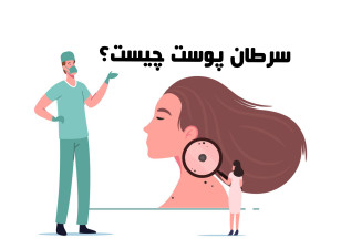 هر آنچه باید درباره‌ی سرطان پوست بدانید
