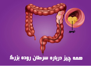 سرطان روده بزرگ چیست ؟ دلایل ابتلا, علائم و روش های درمان سرطان کلورکتال