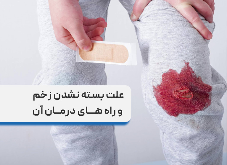 علت بسته نشدن زخم‌ و روش‌های علمی برای بهبود سریع ‌تر